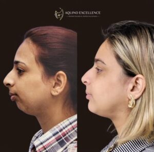 WhatsApp Image 2024-10-11 at 08.46.50