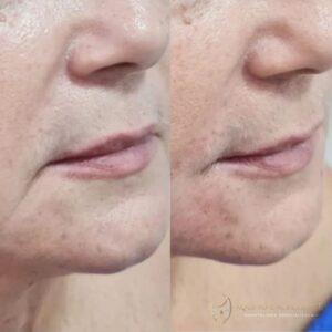 WhatsApp Image 2024-10-11 at 09.21.30