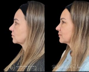 WhatsApp Image 2024-10-11 at 09.24.07